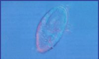 Een trilhaardiertje van nog geen 0,1 mm breed. Dergelijke Ciliata zijn talrijk in de poriën op het oppervlak van een gerijpte spons. Ze vangen voedseldiertjes uit langs stromend water.