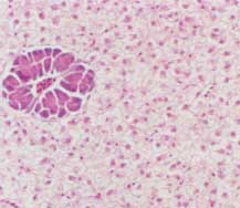 Normale lever van een koi. De levercellen zijn normaal van grootte. Het ronde veldje paarsblauwe cellen is een dwars doorgesneden streng van de alvleesklier. De alvleesklier ligt gedeeltelijk in de lever.