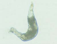 Een exemplaar van Dactylogyrus op de kieuw van een goudvis. Het puntige einde beweegt zich vrij. Met het verbrede gedeelte hecht de worm zich vast op de kieuw. De parasiet veroorzaakt irritatie en ontsteking die met slijmvorming gepaard gaat.